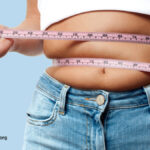 Weight Bias in Health Care