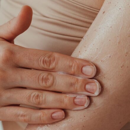 10 Beauty Products and Treatments That Can Trigger a Psoriasis Flare